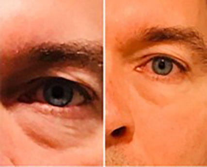 MediSpa Facial Rejuvenation